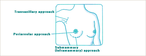 urgical techniques